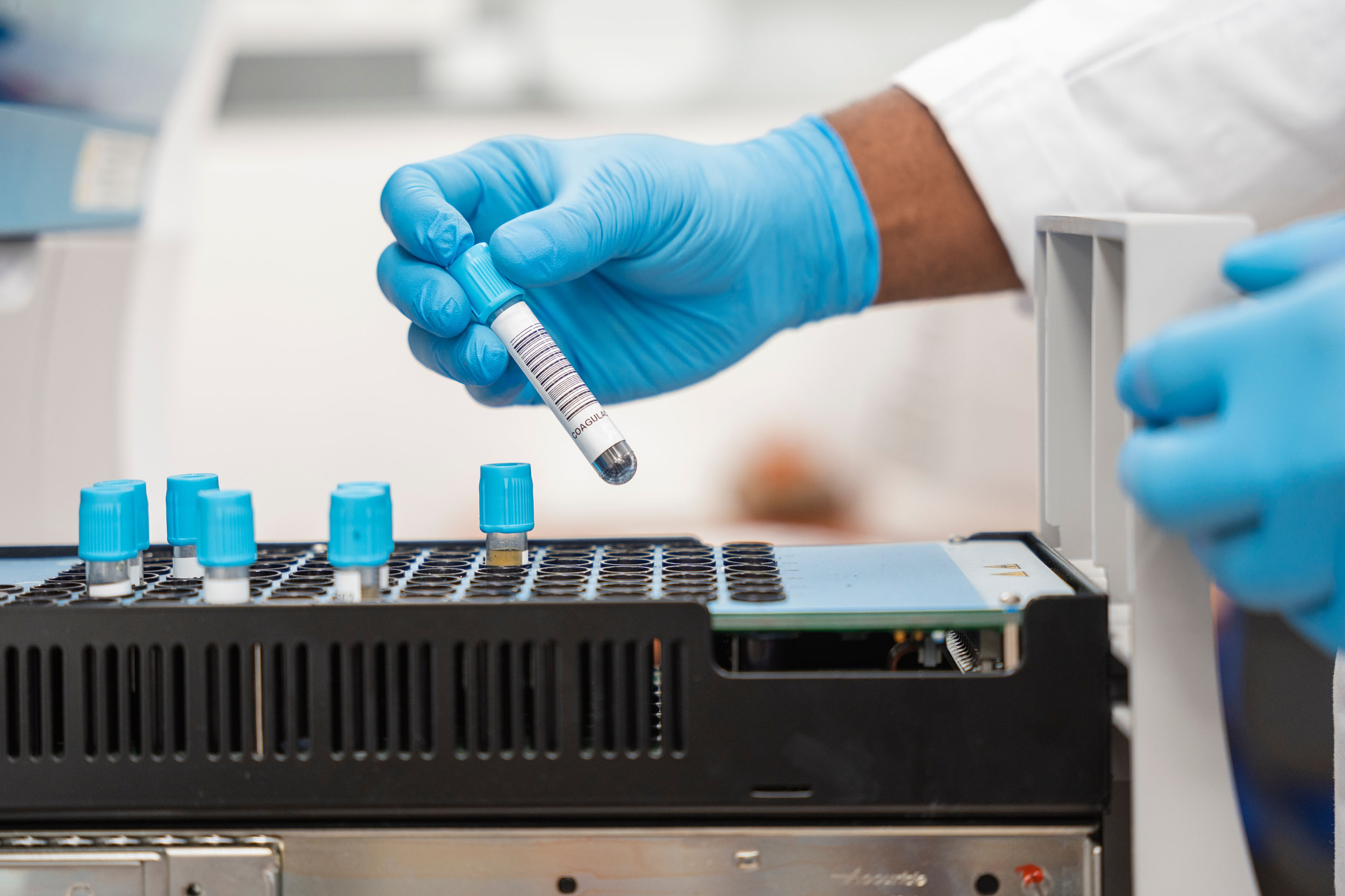hon-lab-technician-blood-sample-tube-rack-789666006.jpg